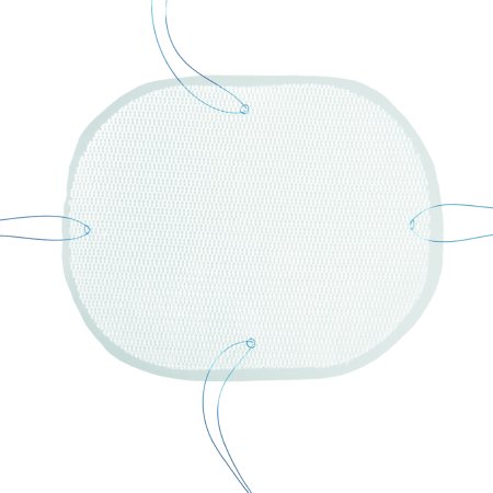 MESH HERNIA REPAIR 15X10 1/BX