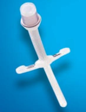TUBE TRACHEOSTOMY UNCUFFEDBIVONA 5.0MM PED FLEXTEND