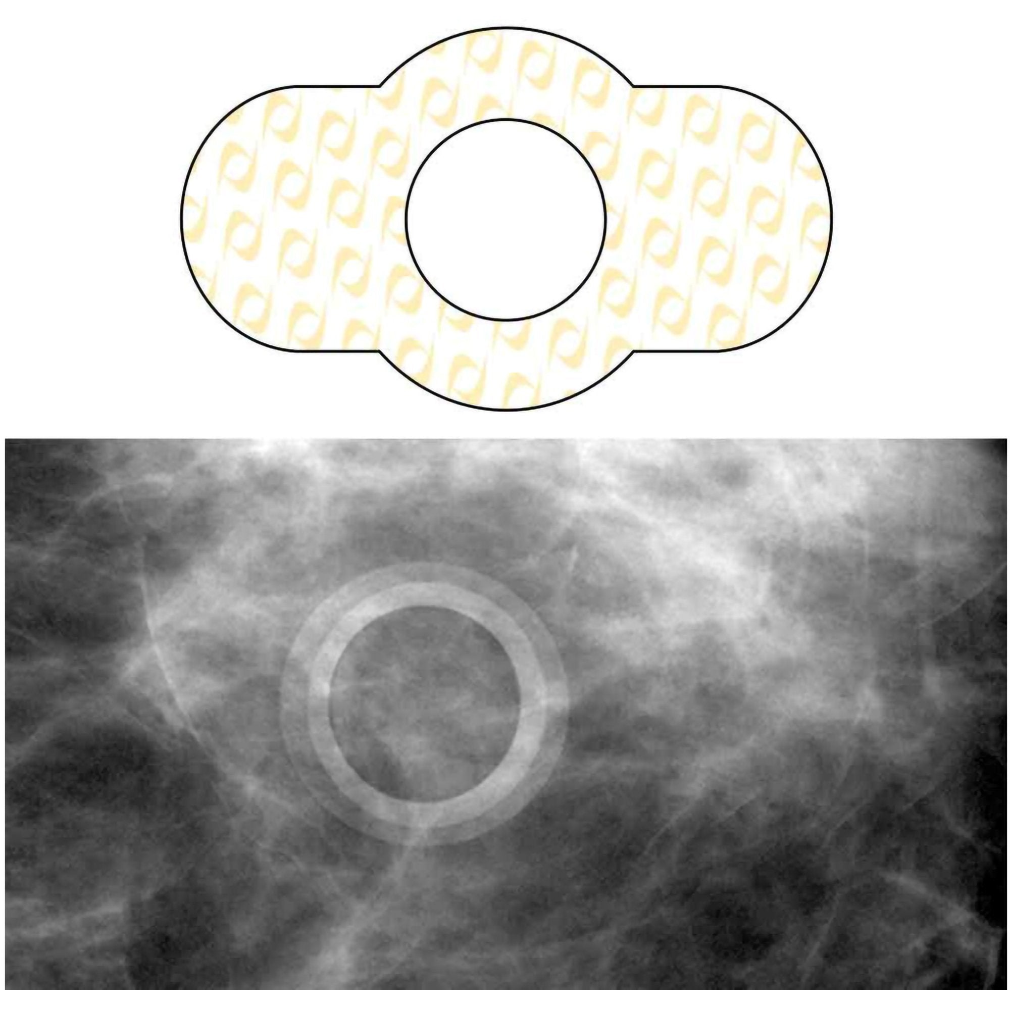 PDC Healthcare Spee-D-Ring Skin Marker (100/BX)