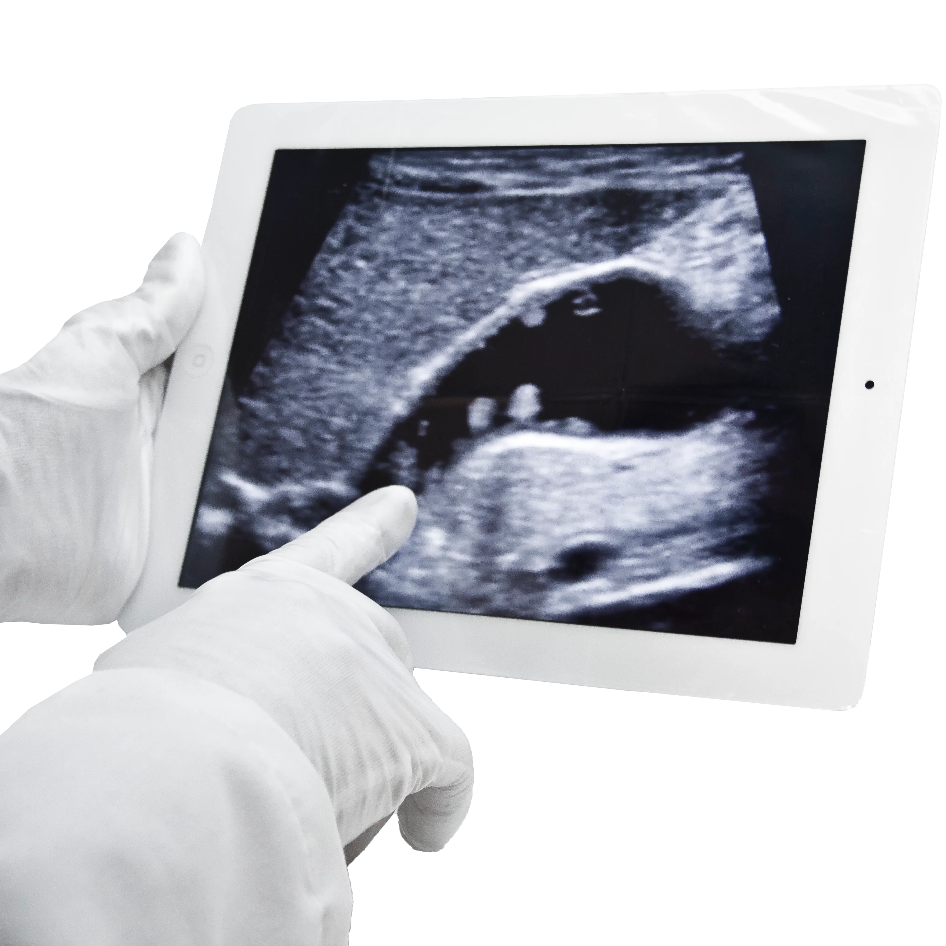 Aspen Protek Tablet Cover