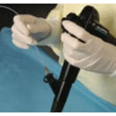 ConMed Biopsy Channel Accessory Introducer - Example