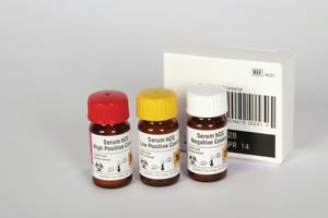 SERUM HCG CONTROL SET 1/SET10SET/CS--SHIP REF--EXP_______