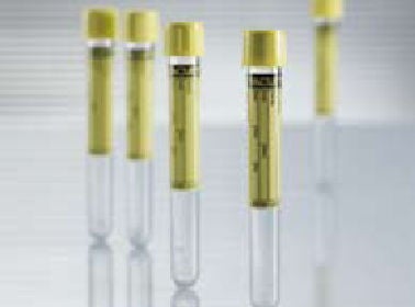 Vacuette Urinalysis Tube, 9 mL, 16 x 100 mm (Case of 1200)