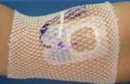 2G Medical LLC ProNet Elastic Net Retainer Dressing, 8-Inch Length (500/CS) 