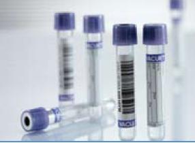 Greiner Bio-One Vacuette Venous Blood Collection Tube, 3 mL, 13 x 75 mm (1200/CS)