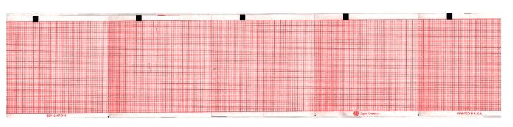 Recording Chart Paper Schiller Z-Fold Red Grid (Case of 8000) 