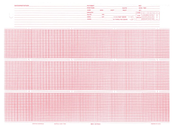 Nissha Medical Tech Recording Chart Paper Burdick Roll Red Grid (20/CS) 