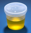 CONTAINER SPECIMEN 5OZ PP300/CS