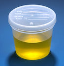 CONTAINER SPECIMEN 5OZ PP300/CS