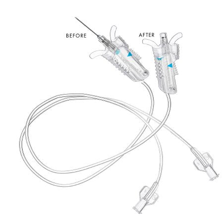 BLOOD COLECT SET W/O LUER ADAP23GX3/4IN W/12IN TUBE 200/CS