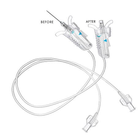 BLOOD COLECT SET W/O LUER ADAP23GX3/4IN W/12IN TUBE 200/CS