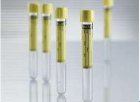 Vacuette Urinalysis Tube, 6 mL, 13 x 100 mm (Case of 1200)