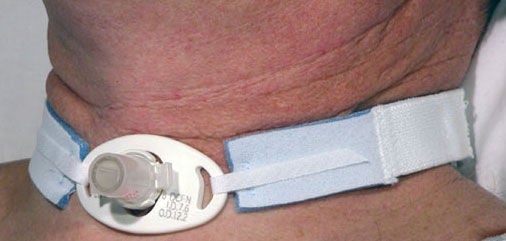 AirLife Tracheostomy Tube Holder (Case of 100)