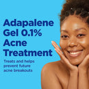 Differin 0.1% Adapalene Gel Acne Treatment, 45-gram Pump Bottle (Each) 