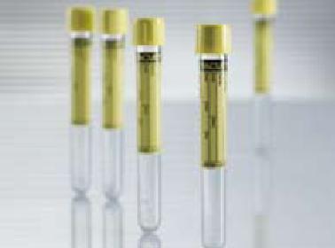 Greiner Bio-One Vacuette Urinalysis Tube, 9 mL, 16 x 100 mm (1200/CA) 