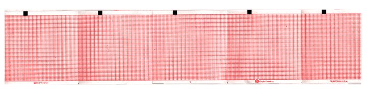 Nissha Medical Tech Recording Chart Paper Schiller Z-Fold Red Grid (8000/CS) 