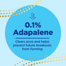 Galderma Laboratories Differin 0.1% Adapalene Gel Acne Treatment, 45-gram Pump Bottle 