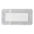 Smith & Nephew Primapore Adhesive Dressing, 10 x 30 Centimeter (200/CS) 