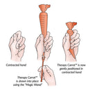 AliMed Original Therapy Carrot Finger Contracture Orthosis Kit, Small (Each)
