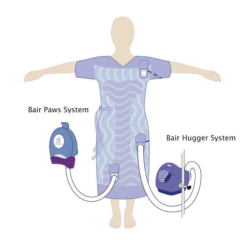 3M Bair Paws Plus Patient Warming Gown  Extra Large: 51" Long; 122" Sweep (20/Case)