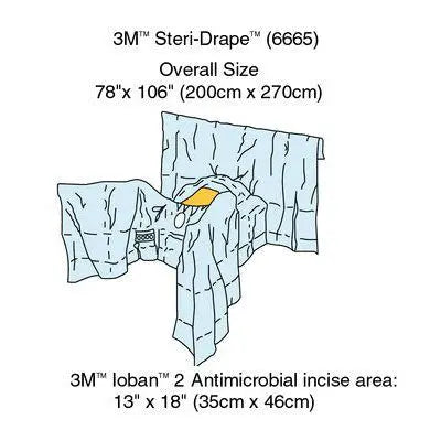 3M Steri-Drape Abdominal-Perineal Drape