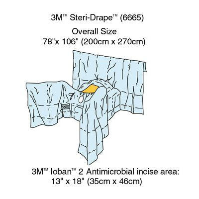 3M Steri-Drape Abdominal-Perineal Drape
