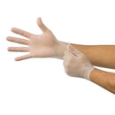 Microflex Medical Derma Free Vinyl Exam Glove, Extra Large, Clear (1000/CS)