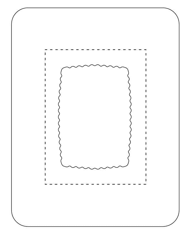 Medline Transparent Film Dressing with Pad SorbaView 2000 5 X 6-1/2 Inch Frame Style Delivery Rectangle Sterile (SV80XT / CS)