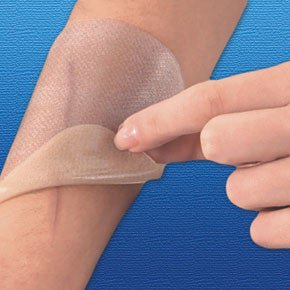 Scar Therapy Gel-Care Advanced Mineral Oil Gel Tan 5-1/2 X 8 Inch NonSterile (Pack)