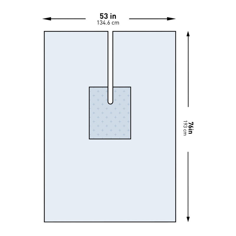 McKesson Sterile U-Drape with Split, 53 x 76 Inch (Case of 26)