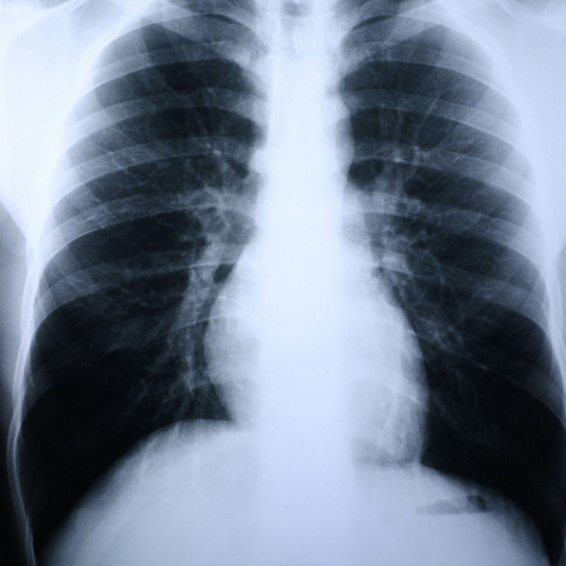 Clear Choice Performance X-Ray Film (Case of 500)