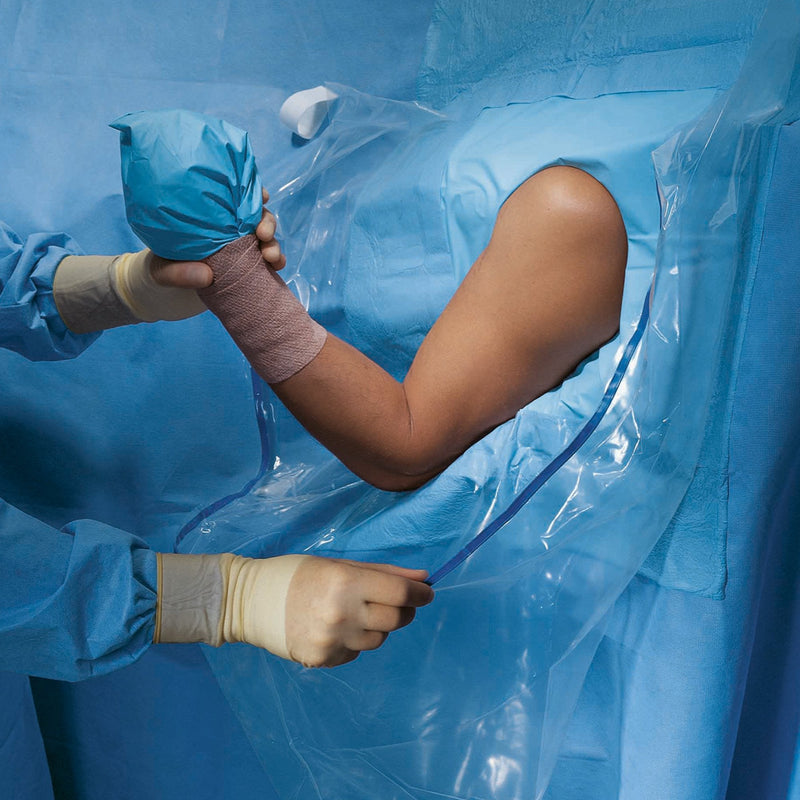 O&M Halyard Inc Halyard Sterile Shoulder Arthroscopy Orthopedic Drape, 160 x 102 Inch (10/CS)