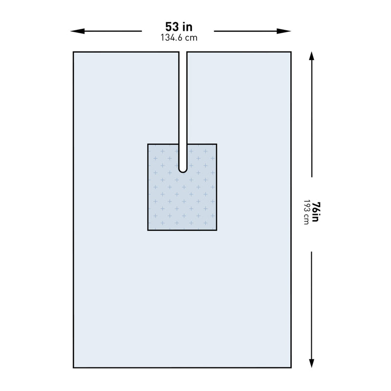 McKesson Sterile U-Drape with Split, 53 x 76 Inch (Case of 26)