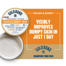 Hand and Body Moisturizer Gold Bond Rough and Bumpy Skin 8 oz. Jar Unscented Cream (Each)
