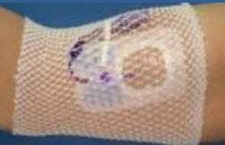 ProNet Elastic Net Retainer Dressing, 8-Inch Length (100/BG)
