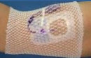 ProNet Elastic Net Retainer Dressing, 8-Inch Length (Case of 500)