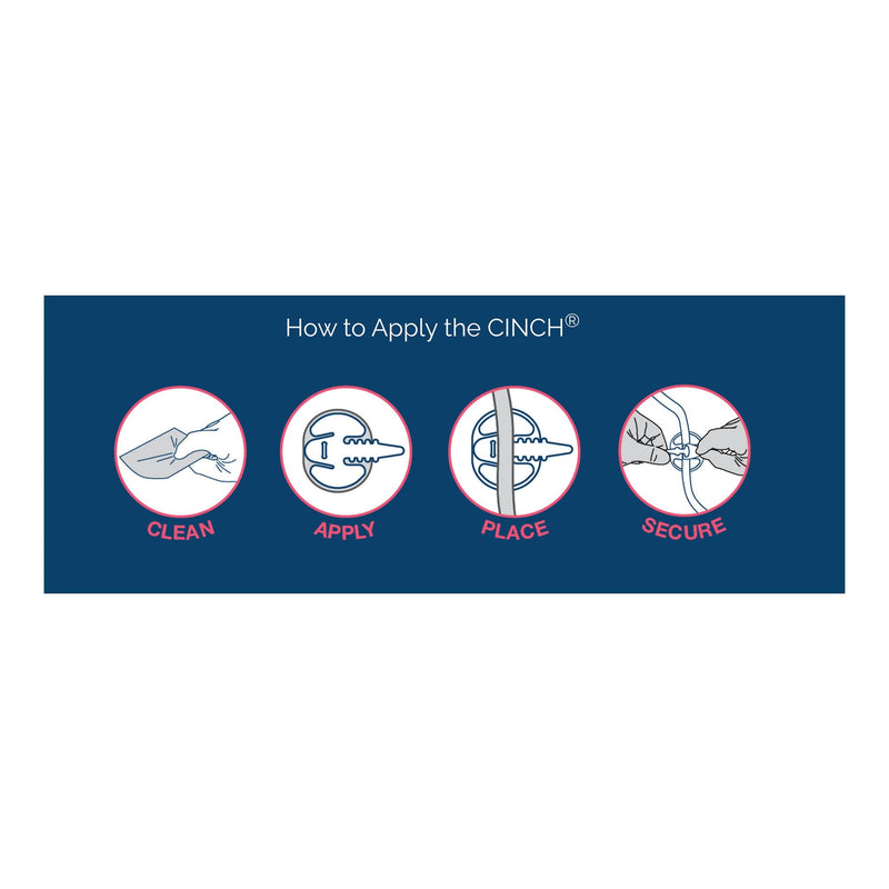 Cinch Tube Securement Device, Large (10/BX) 