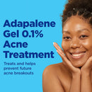 Galderma Laboratories Differin Gel Acne Treatment 