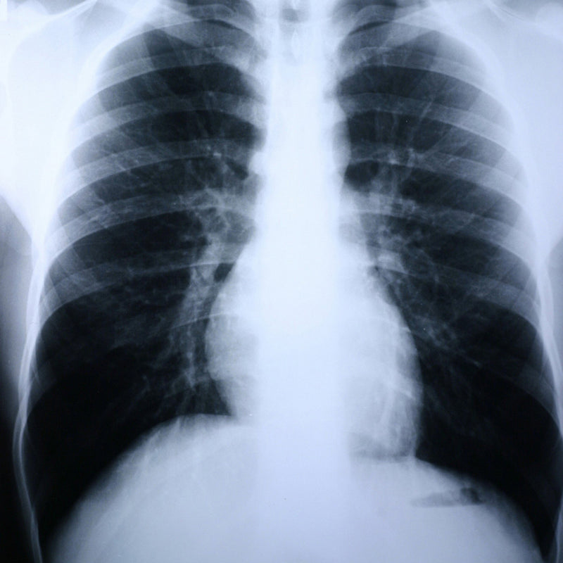 Clear Choice Performance X-Ray Film (Case of 500)