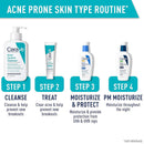 CeraVe 2% Salicylic Acid Acne Control Cleanser with Ceramides & Hectorite Clay (Each)