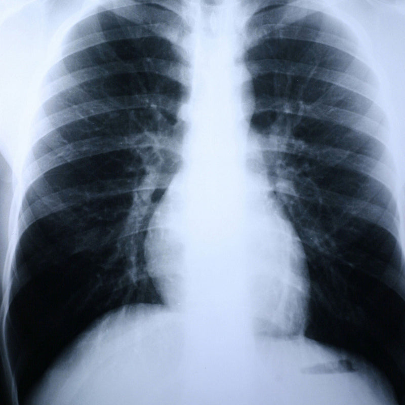 Clear Choice Performance X-Ray Film (Case of 500)