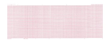 Nissha Medical Tech Recording Chart Paper Marquette Roll Red Grid (18/CS) 