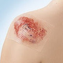 Wound Contact Layer Dressing Cuticell Contact 3 X 4 Inch Sterile (Box of 5)