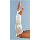 Albahealth, Llc Alba Carenett Mesh Dressing Retainers  Size 3 Dressing Retainer, 25 yds Stretched 1rl/bx