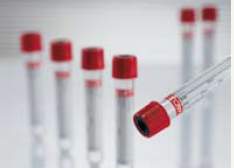 Vacuette Z Serum Clot Activator Venous Blood Collection Tube, 9 mL, 16 x 100 mm