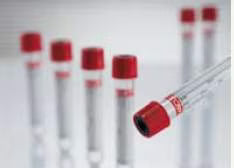 VACUETTE Z Serum Clot Activator Venous Blood Collection Tube Clot Activator Additive 9 mL Pull Cap Polyethylene Terephthalate (PET) Tube 