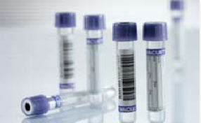 VACUETTE Venous Blood Collection Tube K3 EDTA Additive 4 mL Pull Cap Polyethylene Terephthalate (PET) Tube 