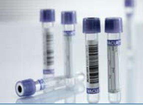 Vacuette Venous Blood Collection Tube (50/EA)