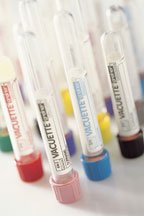 VACUETTE Venous Blood Collection Tube K2 EDTA Additive 6 mL Pull Cap Polyethylene Terephthalate (PET) Tube