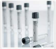 VACUETTE Venous Blood Collection Tube Sodium Fluoride / Potassium Oxalate Additive 4 mL Pull Cap Polyethylene Terephthalate (PET) Tube 